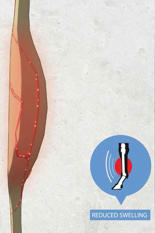 Magnetiske Bandage Pads Recuptex